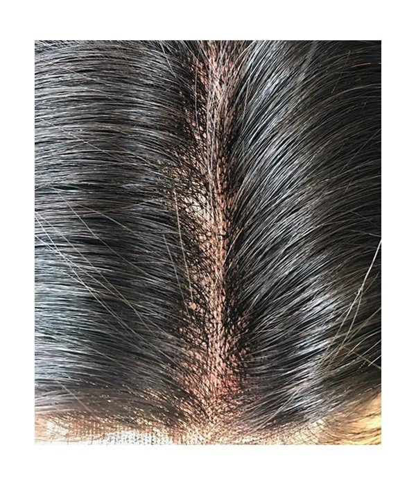 6x6-charleigh-straight-remy-human-hair-lace-hair-topper
